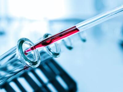 provetta sangue esame