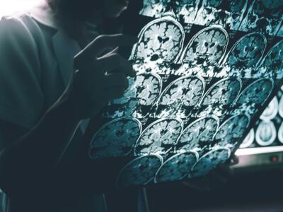 Un gruppo di ricercatori sta utilizzando gli smartphone Pixel 4 per diagnosticare l'Alzheimer