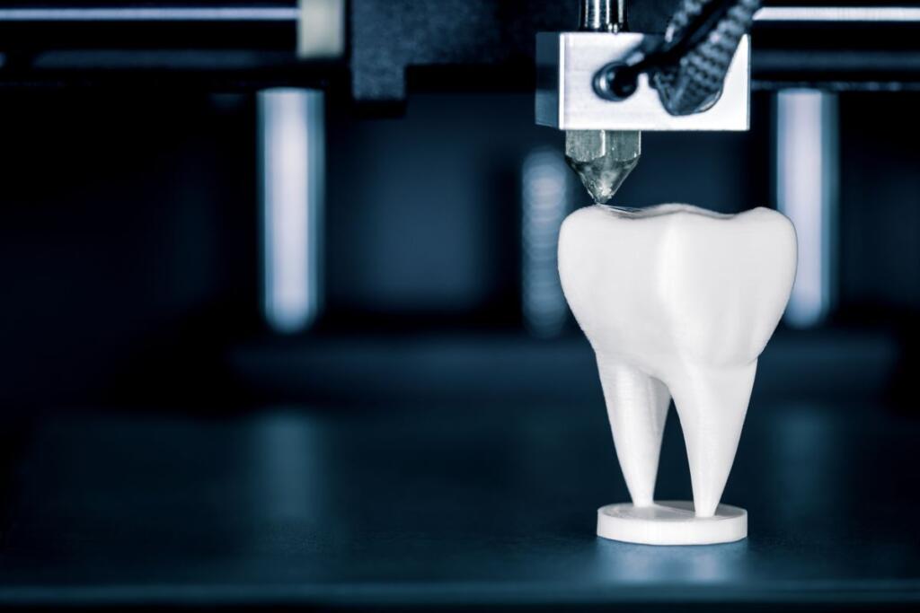 Fabbricazione dente con stampante 3D