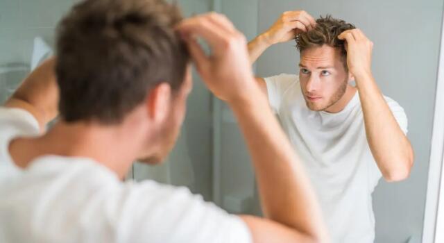 Come risolvere il problema della stempiatura? Tecniche per camuffare il diradamento dei capelli