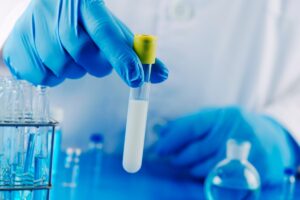 Analisi dello sperma in laboratorio