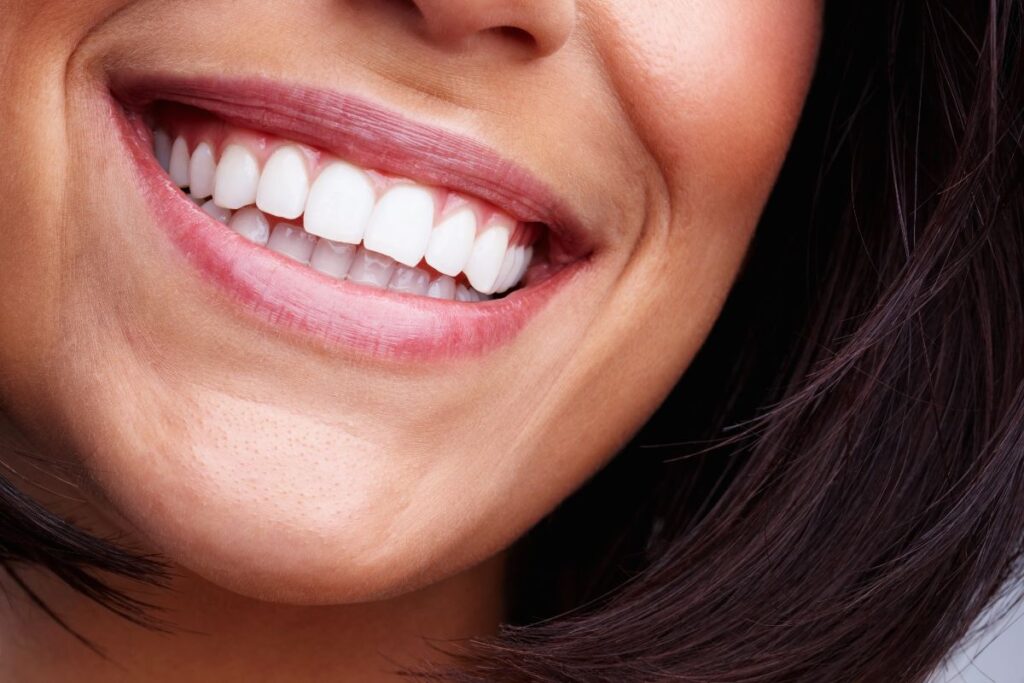 Ragazza che sorride mostrando denti perfetti