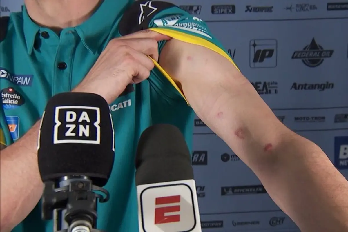 Rins colpito da pezzi di asfalto durante il Gp del Brasile di MotoGP